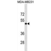 Protein-Lysine 6-Oxidase (LOX) Antibody