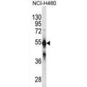 Cytochrome P450 2C9 (CYP2C9) Antibody