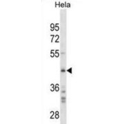 SPARC (SPARC) Antibody