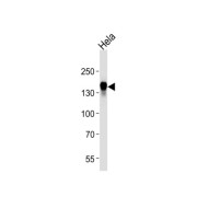 Epidermal Growth Factor Receptor (EGFR) Antibody