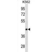 Lymphoid Enhancer Binding Factor 1 (LEF1) Antibody