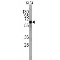 Krueppel-Like Factor 4 (KLF4) Antibody