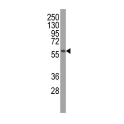 Serine/Threonine-Protein Kinase PINK1, Mitochondrial (PINK1) Antibody