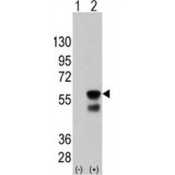 Serine/Threonine-Protein Kinase PINK1, Mitochondrial (PINK1) Antibody