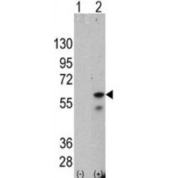 Serine/Threonine-Protein Kinase PINK1, Mitochondrial (PINK1) Antibody