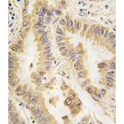 Superoxide Dismutase 2 (SOD2) Antibody