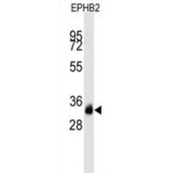 Ephrin Type-B Receptor 2 (EPHB2) Antibody