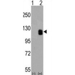 Ephrin Type-B Receptor 2 (EPHB2) Antibody