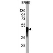 EPH Receptor A4 (EPHB4) Antibody