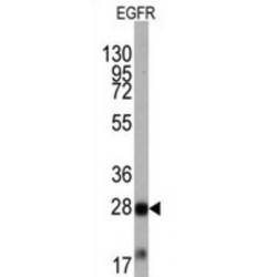 Epidermal Growth Factor Receptor (EGFR) Antibody