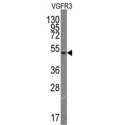 Vascular Endothelial Growth Factor Receptor 3 (VGFR3) Antibody