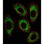 SRC Proto-Oncogene, Non-Receptor Tyrosine Kinase (SRC) Antibody