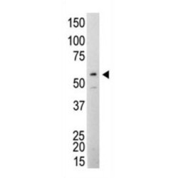 SRC Proto-Oncogene, Non-Receptor Tyrosine Kinase (SRC) Antibody