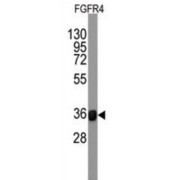 Fibroblast Growth Factor Receptor 4 (FGFR4) Antibody