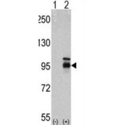 Fibroblast Growth Factor Receptor 4 (FGFR4) Antibody