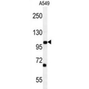 Probable C-Mannosyltransferase DPY19L2 (DPY19L2) Antibody