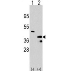 Protein Arginine N-Methyltransferase 1 (PRMT1) Antibody