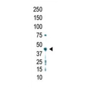 Protein Arginine N-Methyltransferase 2 (PRMT2) Antibody