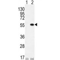 Protein Arginine N-Methyltransferase 2 (PRMT2) Antibody