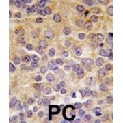 Protein Arginine Methyltransferase 3 (PRMT3) Antibody