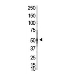 Protein Arginine Methyltransferase 3 (PRMT3) Antibody