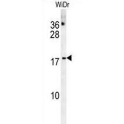 Coiled-Coil-Helix-Coiled-Coil-Helix Domain Containing Protein 2 (CHCHD2) Antibody