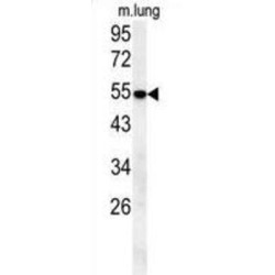 Solute Carrier Family 43 Member 2 (SLC43A2) Antibody