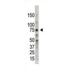 Protein Arginine N-Methyltransferase 5 (PRMT5) Antibody