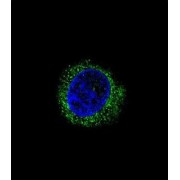 Alpha-2-HS-Glycoprotein (AHSG) Antibody