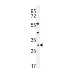 Apolipoprotein F (APOF) Antibody