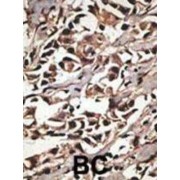 Protein Arginine N-Methyltransferase 7 (PRMT7) Antibody