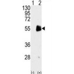 Protein Arginine N-Methyltransferase 7 (PRMT7) Antibody