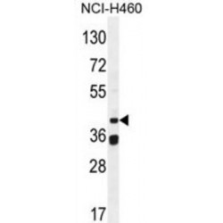 Seipin (BSCL2) Antibody