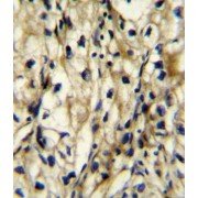 Branched Chain Aminotransferase 1, Cytosolic (BCAT1) Antibody