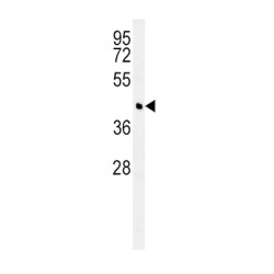 Branched Chain Aminotransferase 1, Cytosolic (BCAT1) Antibody