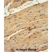 Metalloproteinase Inhibitor 4 (TIMP4) Antibody