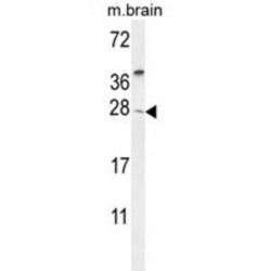 Metalloproteinase Inhibitor 4 (TIMP4) Antibody