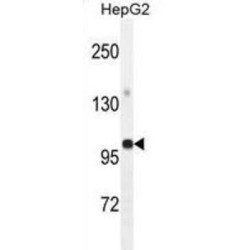 Glycerol-3-Phosphate Acyltransferase, Mitochondrial (GPAM) Antibody