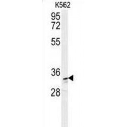 Aldo-Keto Reductase Family 1 Member C3 (AKR1C3) Antibody