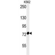 Heat Shock 70 kDa Protein 9 (HSPA9) Antibody