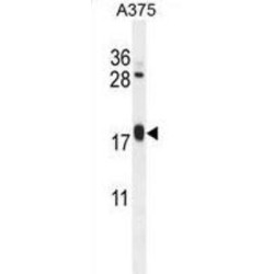 ADP-Ribosylation Factor-Like Protein 8A (ARL8A) Antibody