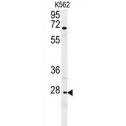 Chemokine C-X-C-Motif Receptor 3 (CXCR3) Antibody