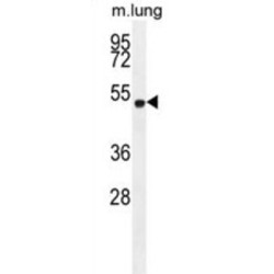 Elongation Factor RNA Polymerase II (ELL) Antibody