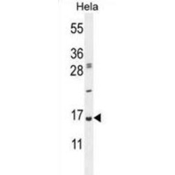 Ubiquitin A 52 Residue Ribosomal Protein Fusion Product 1 (UBA52) Antibody