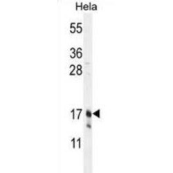 Claudin 7 (CLDN7) Antibody