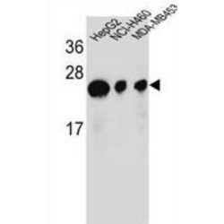 ATP Synthase Subunit D, Mitochondrial (ATP5PD) Antibody