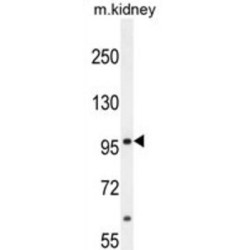 Mediator of RNA Polymerase II Transcription Subunit 25 (MED25) Antibody