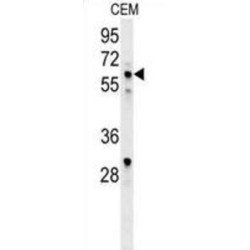 DNA-Binding Protein Ikaros (IKZF1) Antibody