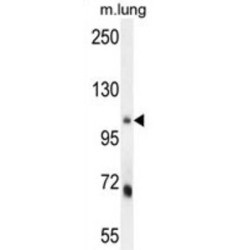 MLX Interacting Protein (MLXIP) Antibody