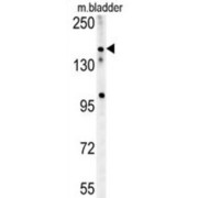 Castor Zinc Finger 1 (CASZ1) Antibody